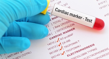 تشخیص سریع مارکرهای قلبی